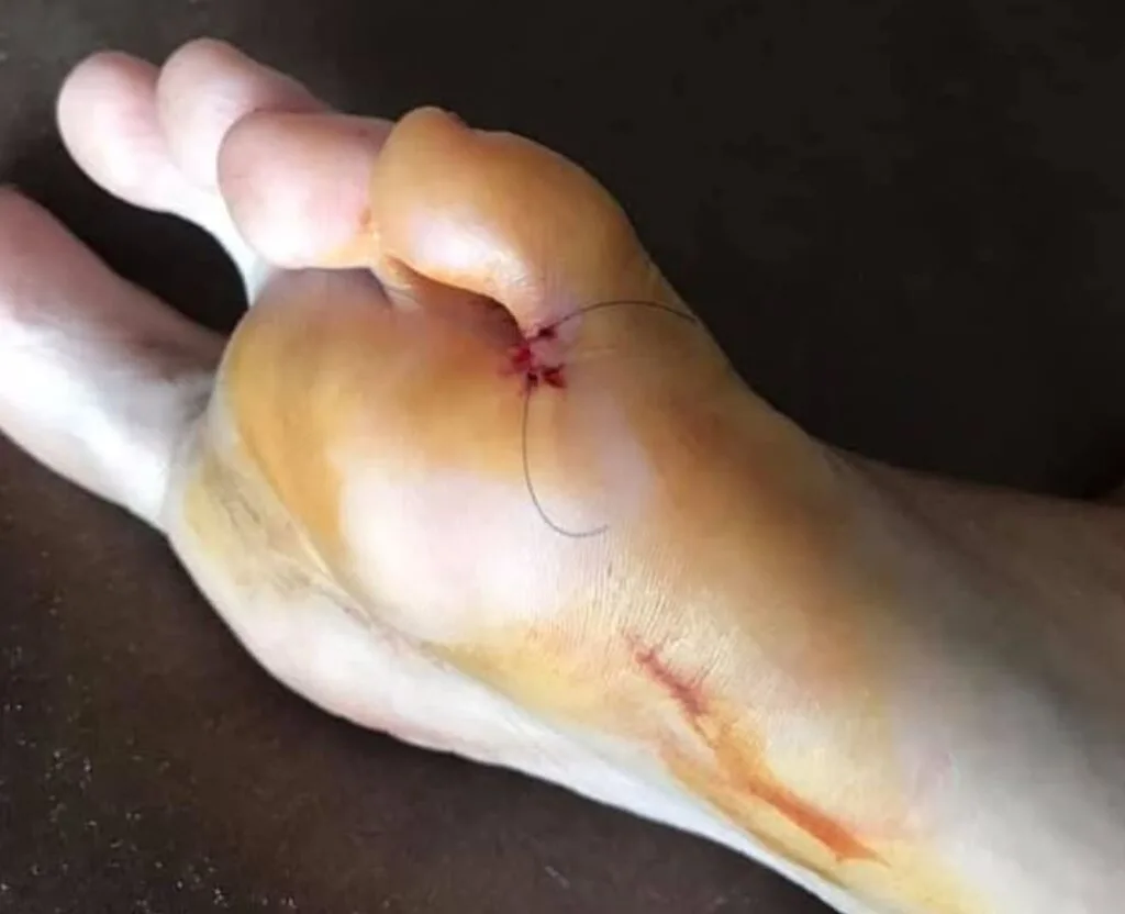 stiched foot