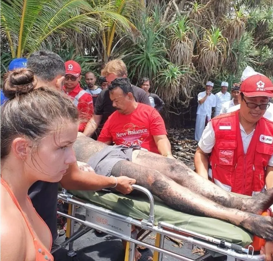 Russian tourist male survive