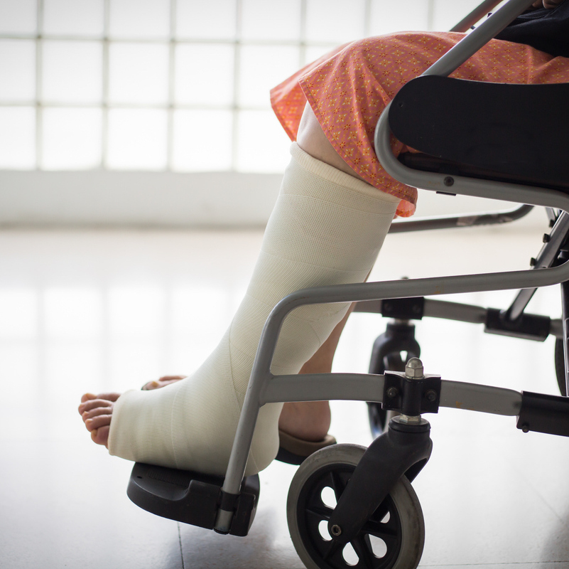 woman with fractured legs