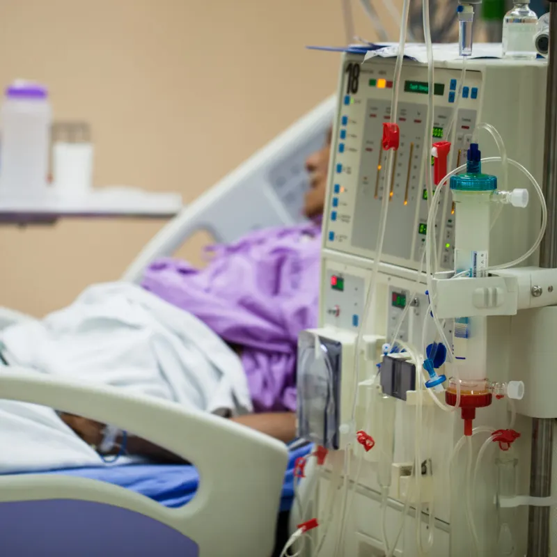 Patient In Hospital On Dialysis Machine