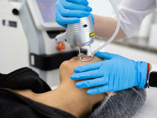 Cosmetic Laser Medical at Hospital in Bali.jpg